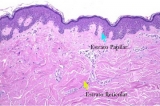 Dermis conjuntiva: estratos papilar y reticular