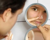Acné y bacterias: cepas buenas y malas