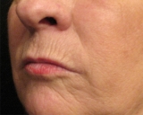 Por qué las mujeres envejecen más alrededor de los labios que los hombres