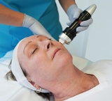 Radiofrecuencia fraccionada: tecnología para la estimulación de colágeno y el tensado cutáneo